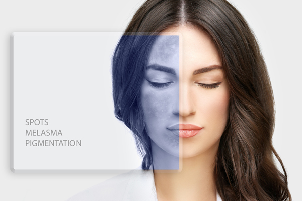 Cosmelan Behandlung Cosmelan