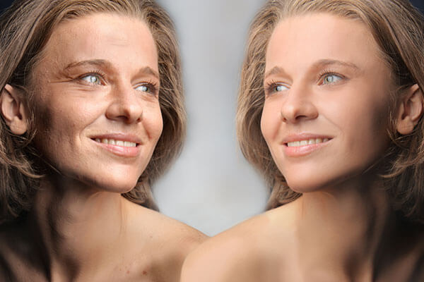skinbooster